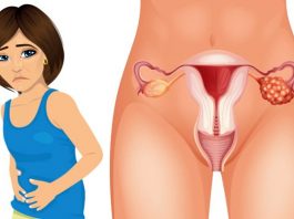 5 symptômes précoces du cancer de l'ovaire que chaque femme doit connaître !