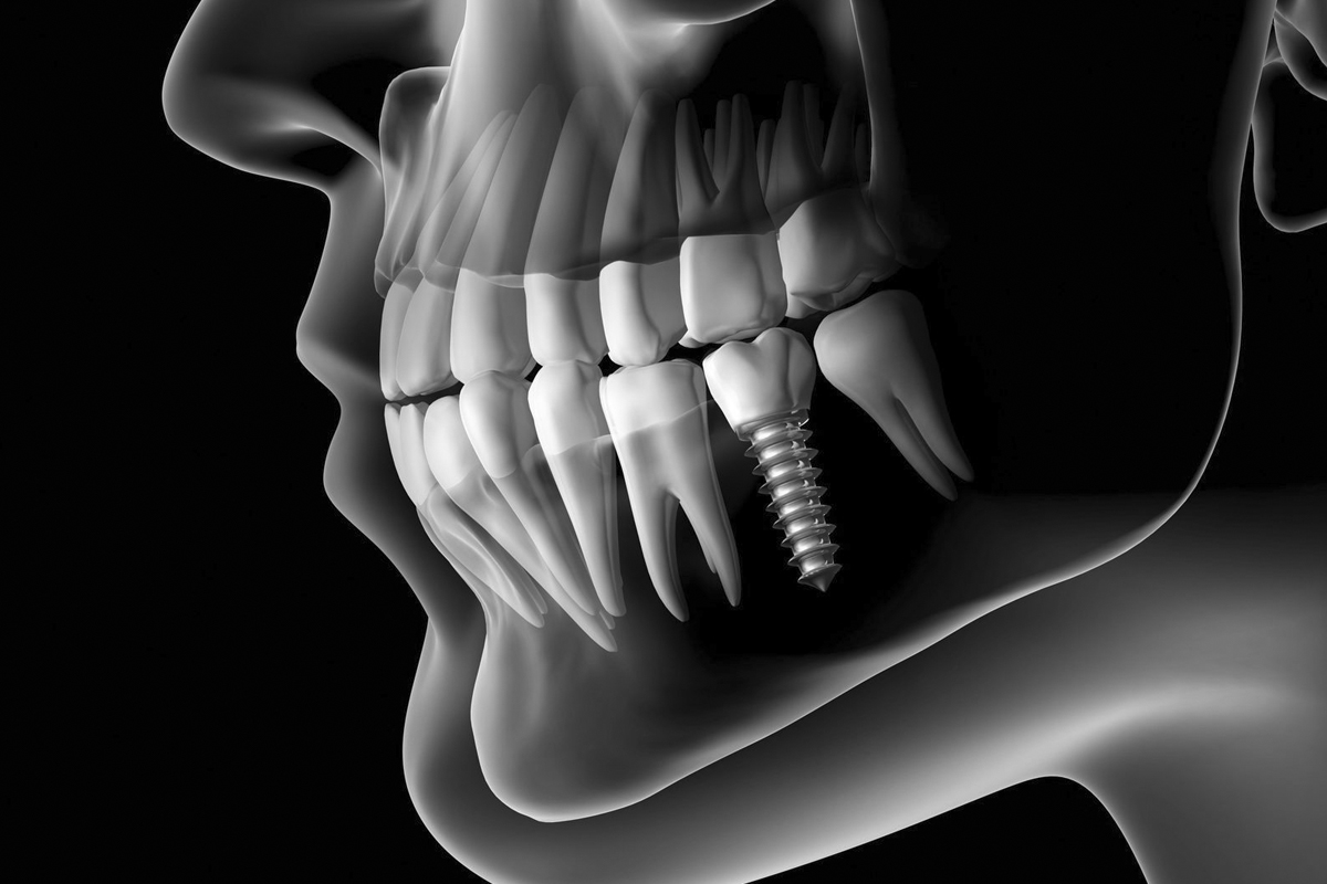 Plus d'implants dentaires, un dentiste fait pousser de nouvelles dents en seulement 9 semaines !