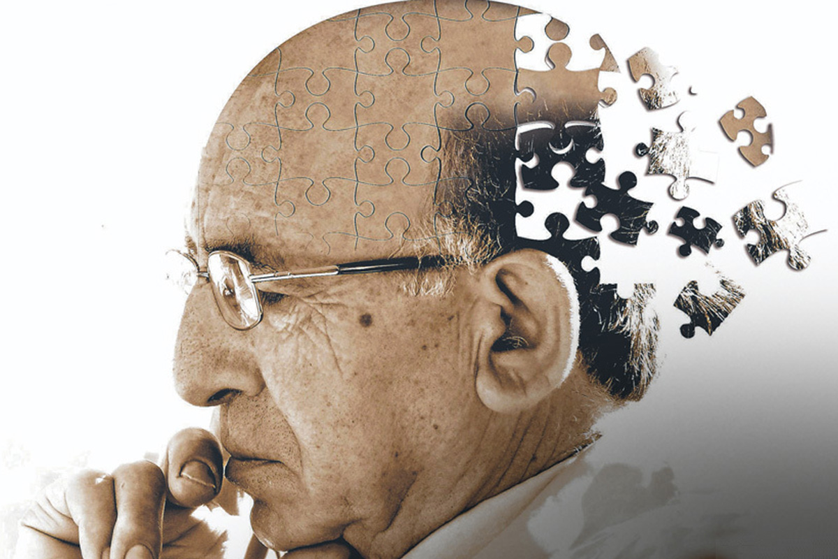 Les virus de l'herpès pourraient-ils jouer un rôle dans la maladie d'Alzheimer ?